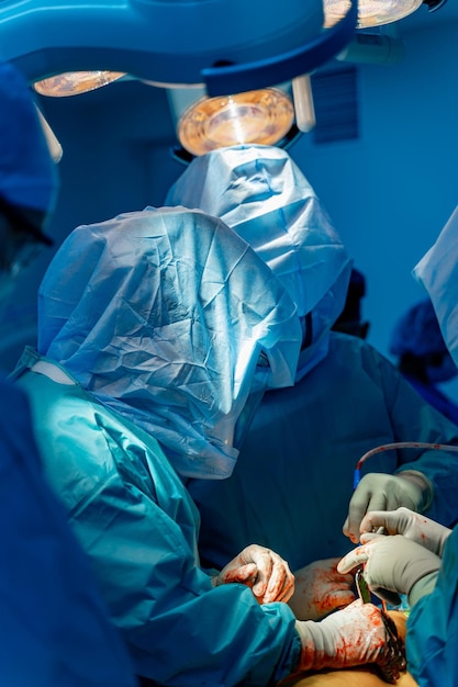 Foto operación de cirugía durante la pandemia traje de protección especial equipo moderno en el hospital