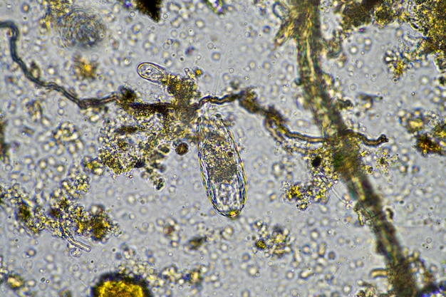 Organismos de micróbios do solo em uma amostra de solo e composto de fungos e fungos e sob o microscópio na agricultura regenerativa na austrália
