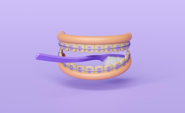 Ortodontia 3D: aparelhos dentários de desenho animado com escova de dentes limpa isolada em fundo roxo