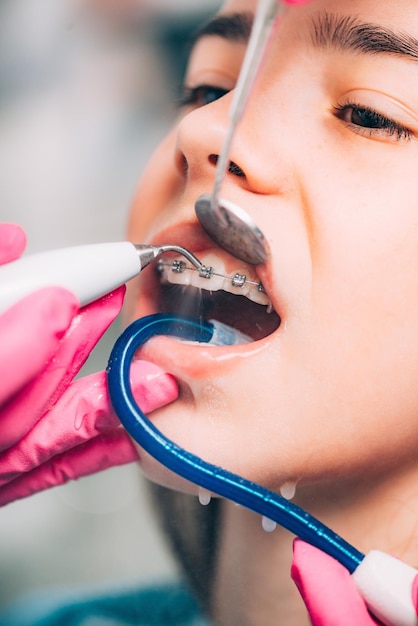 Foto ortodontista limpando os dentes da menina com aparelho dentário