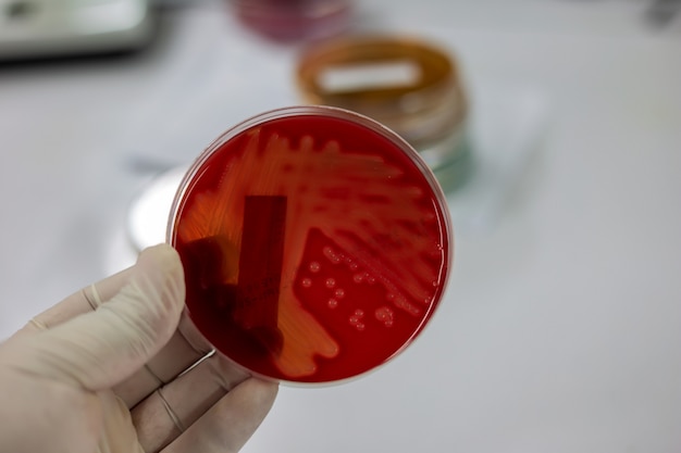 Foto os cientistas estão segurando uma placa de cultura bacteriana.