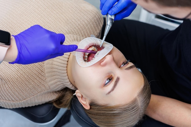 Os dentes de uma mulher com aparelho ortodôntico estão sendo tratados na clínica. Um ortodontista usa instrumentos dentários para colocar aparelho nos dentes de um paciente. Foco seletivo