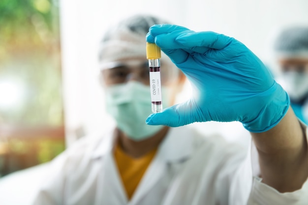 Os pesquisadores testam amostras de sangue COVID-19 no laboratório.