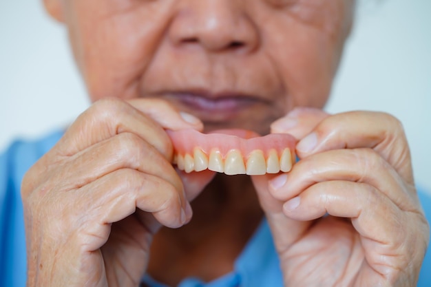 Paciente anciana asiática con dentadura postiza en la boca para masticar comida