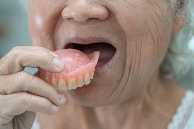 Paciente asiática anciana o anciana sosteniendo para usar dentadura postiza en la sala del hospital de enfermería, concepto médico fuerte y saludable