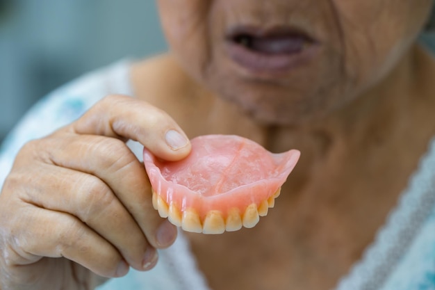 Paciente asiática idosa ou idosa segurando para usar dentadura na enfermaria do hospital de enfermagem conceito médico forte saudável