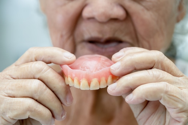 Paciente asiática idosa segurando uma dentadura em hospital de enfermagem