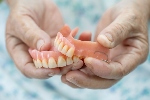 Paciente asiática idosa segurando uma dentadura em hospital de enfermagem