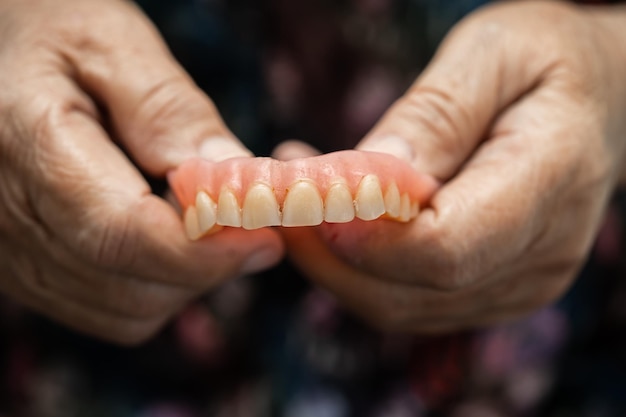 Paciente asiática mayor o anciana sosteniendo para usar dentadura postiza en la sala del hospital de enfermería concepto médico fuerte y saludable