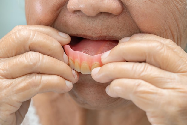 Paciente asiático mayor o anciano sosteniendo para usar dentadura en la sala del hospital de enfermería, concepto médico fuerte y saludable