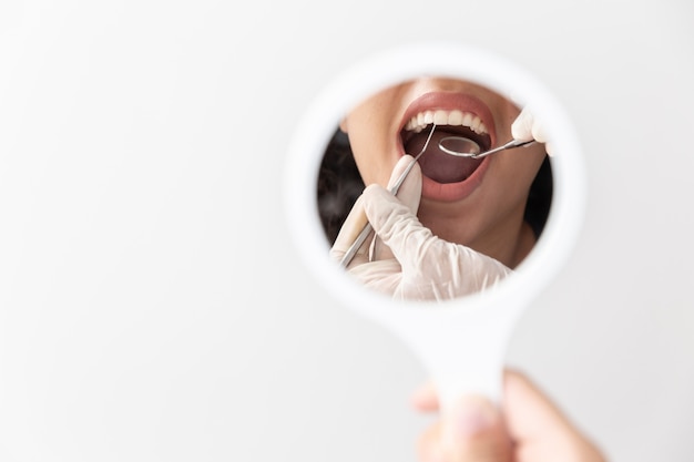 Foto paciente boca abierta durante el chequeo oral por el espejo del dentista. de cerca.