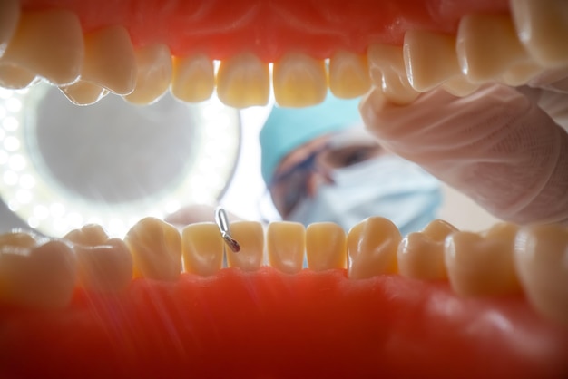 Paciente em uma consulta de dentista em uma clínica odontológica. Vista de dentro da mandíbula dental.