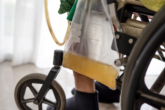 Foto paciente mujer asiática dama sentada en silla de ruedas con bolsa de orina en la sala del hospital, concepto médico saludable