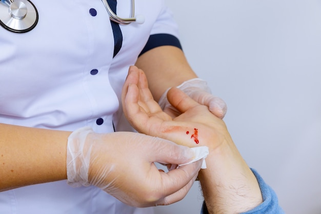 Paciente que visita médico de ferimento na mão limpa o sangue limpando uma ferida