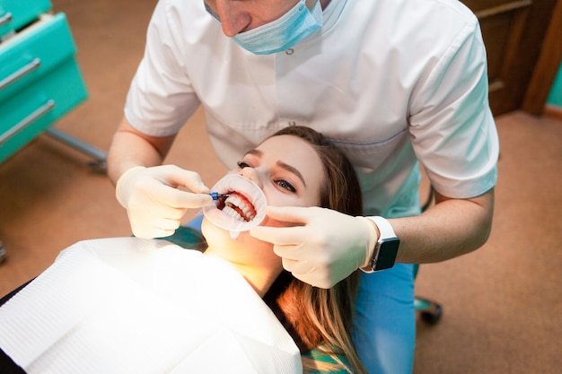 El paciente con retractor de mejillas se acuesta en la silla dental durante el procedimiento de blanqueamiento dental