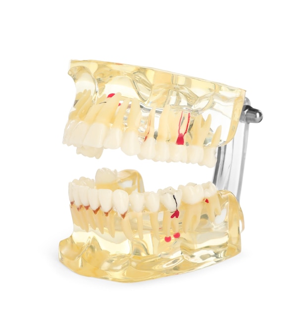 Pädagogisches dentales Typodontmodell lokalisiert auf Weiß