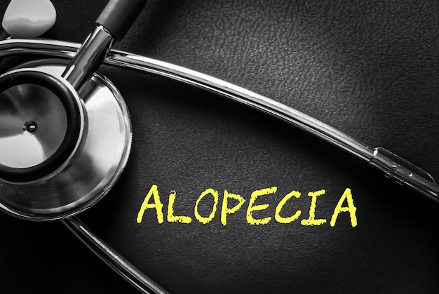 Palabra de alopecia, término médico con conceptos médicos en pizarra y antecedentes de equipos médicos.