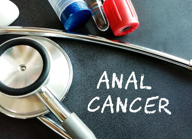 Palavra de termo médico de câncer anal com conceitos médicos em quadro-negro e equipamentos médicos