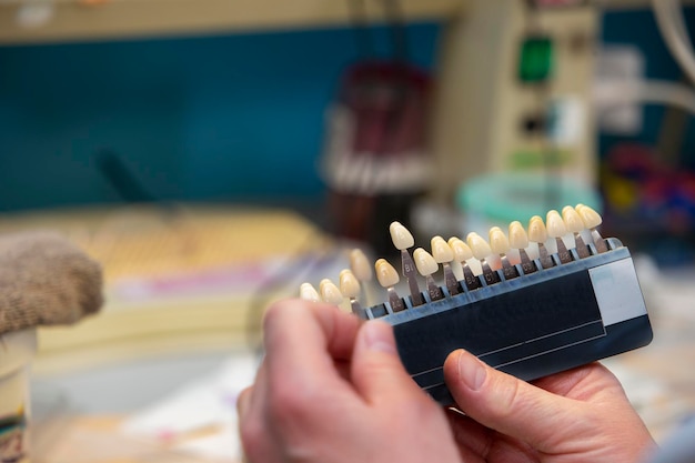 Una paleta para determinar el color de los dientes en manos de un ortopedista dental