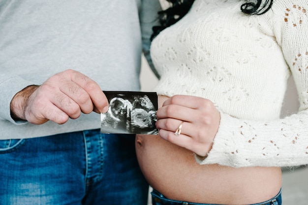 Pareja embarazada sosteniendo en la ecografía de manos de su bebé