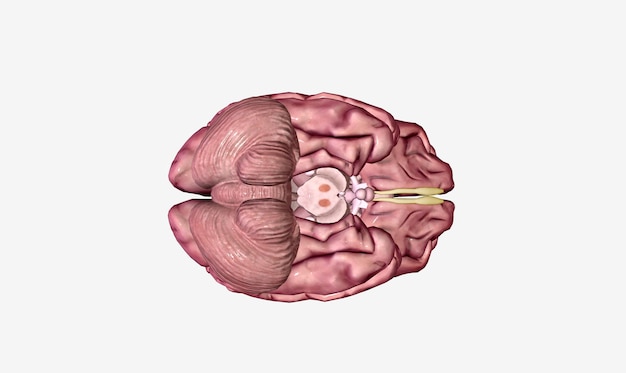 Foto parkinson es una enfermedad en el cerebro medio