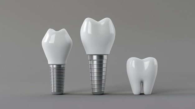 Partes de um implante dentário em fundo cinzento