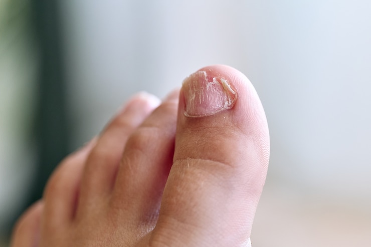 Foto pé de menino de 8 anos com unhas fracas, isolado, sem rosto