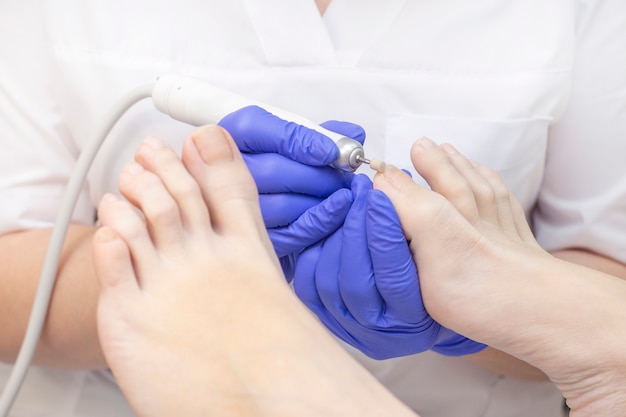 Foto pedicura terapéutica. maestro podólogo hace pedicura de hardware. visita a la podología. tratamiento de pies en el spa. clínica de podiatria.