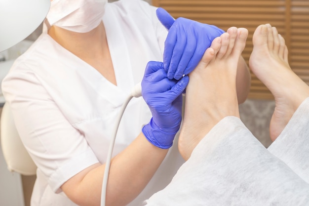 Pedicure terapêutico. Mestre podologista faz pedicure de hardware. visita à podologia. Tratamento de pés no spa. Clínica de Podiatria.