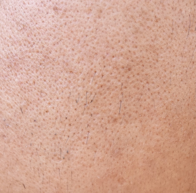 Foto pele de rosto de homem asiático de superfície