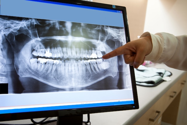 Película dental de rayos x para el concepto de cuidado dental