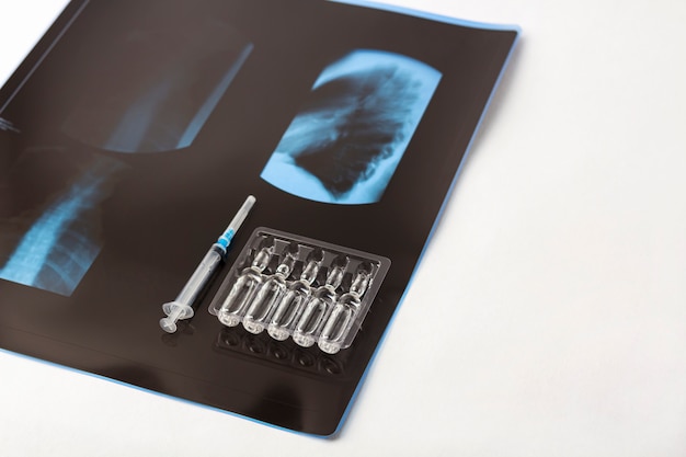 Película de rayos X de pulmones y jeringas con frascos de vacunas. Síntoma de tratamiento Coronavirus, COVID-19, concepto de neumonía y bronquitis. vacunación. Vacuna contra enfermedades infecciosas.