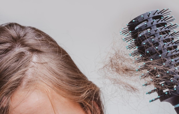 La pérdida de cabello de cerca macro de cabello problema enredado