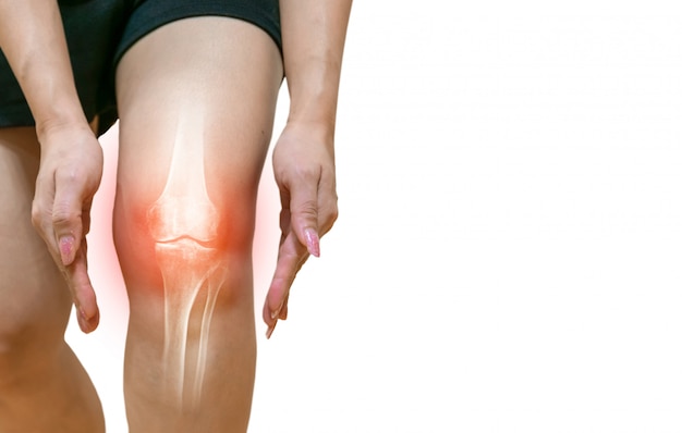 Perna humana Osteoartrite inflamação Das articulações ósseas