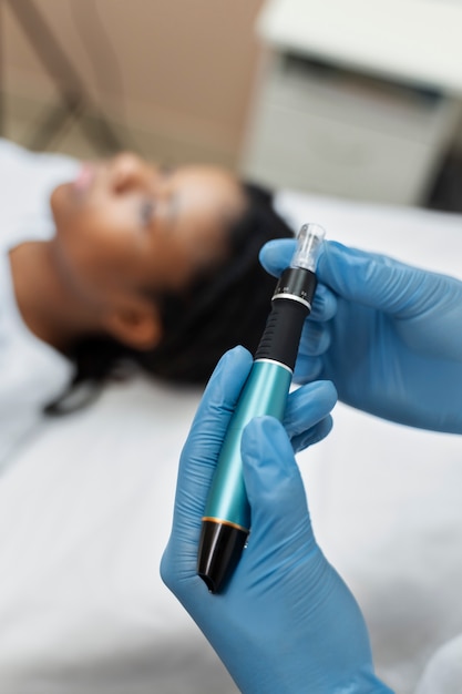 Person, die eine Microneedling-Schönheitsbehandlung erhält