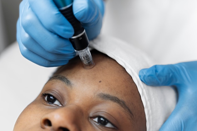 Foto persona que recibe un tratamiento de belleza con microagujas