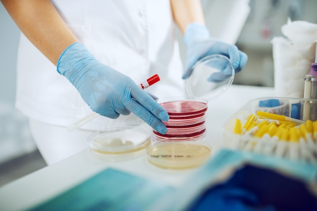 Perto de assistente de laboratório feminino caucasiano com luvas de borracha estéril, abrindo a placa de Petri e segurando um cotonete na mão.