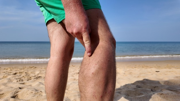 Pessoa em uma praia de areia apontando para um músculo da perna contra um fundo de mar calmo possivelmente indicando