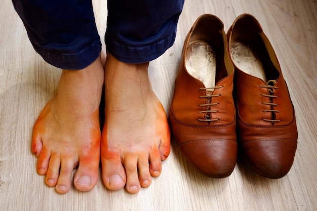 La piel de la mujer en los pies está coloreada de color naranja con zapatos mojados