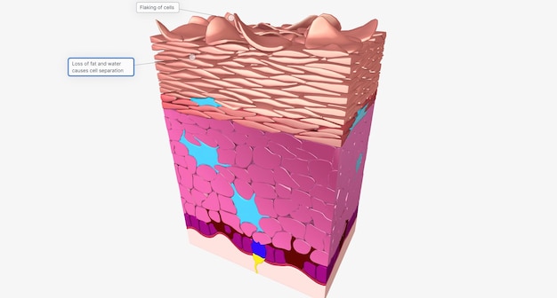 Foto la piel seca en la epidermis