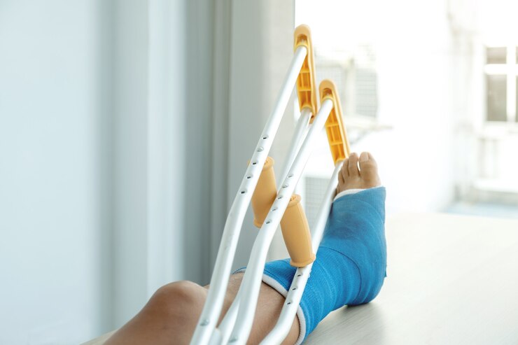 La pierna del hombre usa muletas para caminar después de la cirugía recuperación lesión huesos rotos.