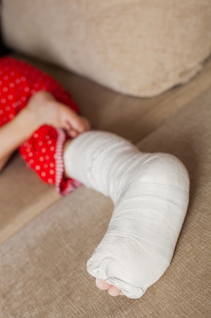 Pierna en yeso de una adolescente en un sofá después de una caída accidental con una fractura de tobillo