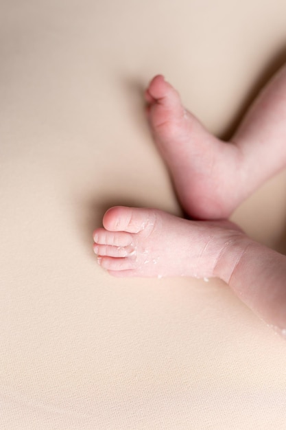 las piernas del bebé recién nacido. las piernas de la piel escamosa del recién nacido. despegar la piel. descamación de la piel ne