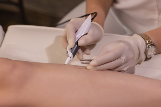 Piernas femeninas en hoja morada durante la depilación por una esteticista profesional con guantes. Spa, industria de la belleza, tratamiento en clínica, electrólisis.