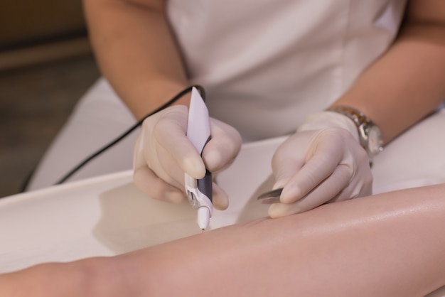 Piernas femeninas en hoja morada durante la depilación por una esteticista profesional con guantes. Spa, industria de la belleza, tratamiento en clínica, electrólisis.
