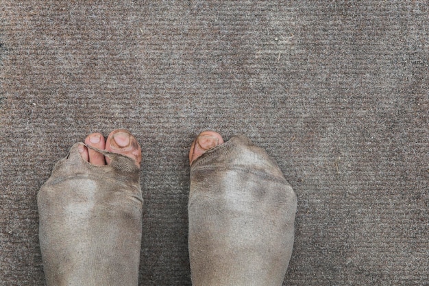 Pies masculinos sucios en calcetines desgastados con fugas. Pobreza. Fondo