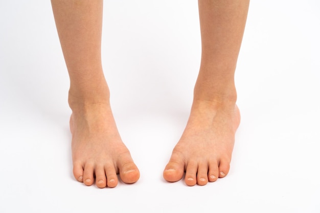 Foto los pies de los niños sobre un fondo blanco vista trasera el concepto de prevención de los pies planos de los niños