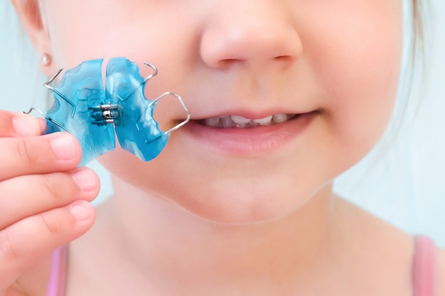 Placa dental. Expansión de la mandíbula en un niño. Un plato al cielo. No hay suficiente espacio para los molares. Niña feliz sosteniendo una placa de ortodoncia en sus manos