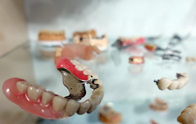 Placa dental de porcelana de circonio en la tienda de dentistas Foto detallada macro