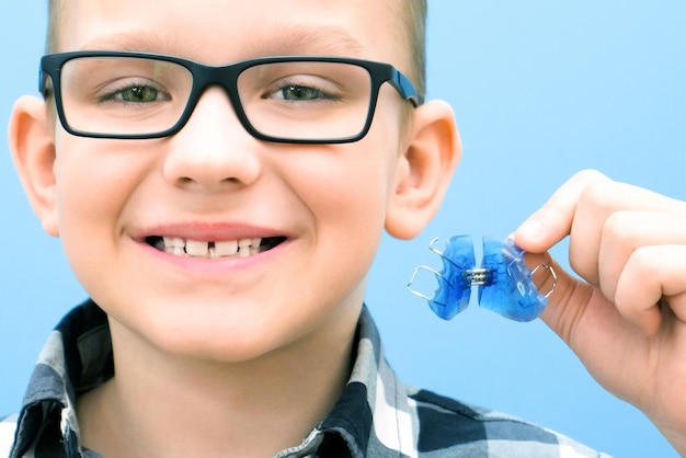 Placa de ortodoncia dental Expansión de la mandíbula en un niño Placa en el cielo No hay suficiente espacio para los molares Niño feliz sosteniendo una placa de ortodoncia en sus manos